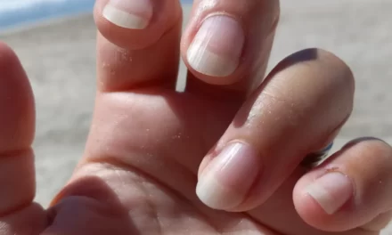 Check Out Those Nails